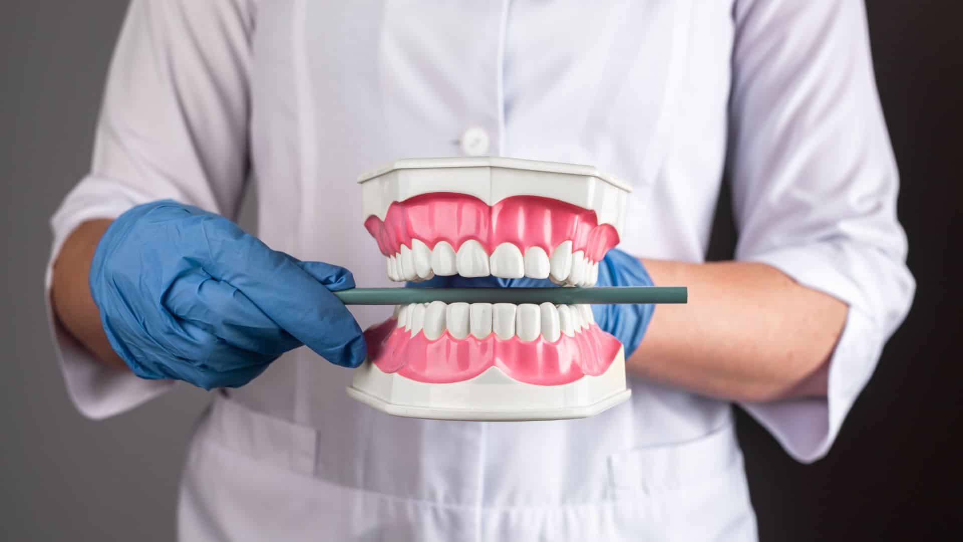 Orthodontic Impaction Cases