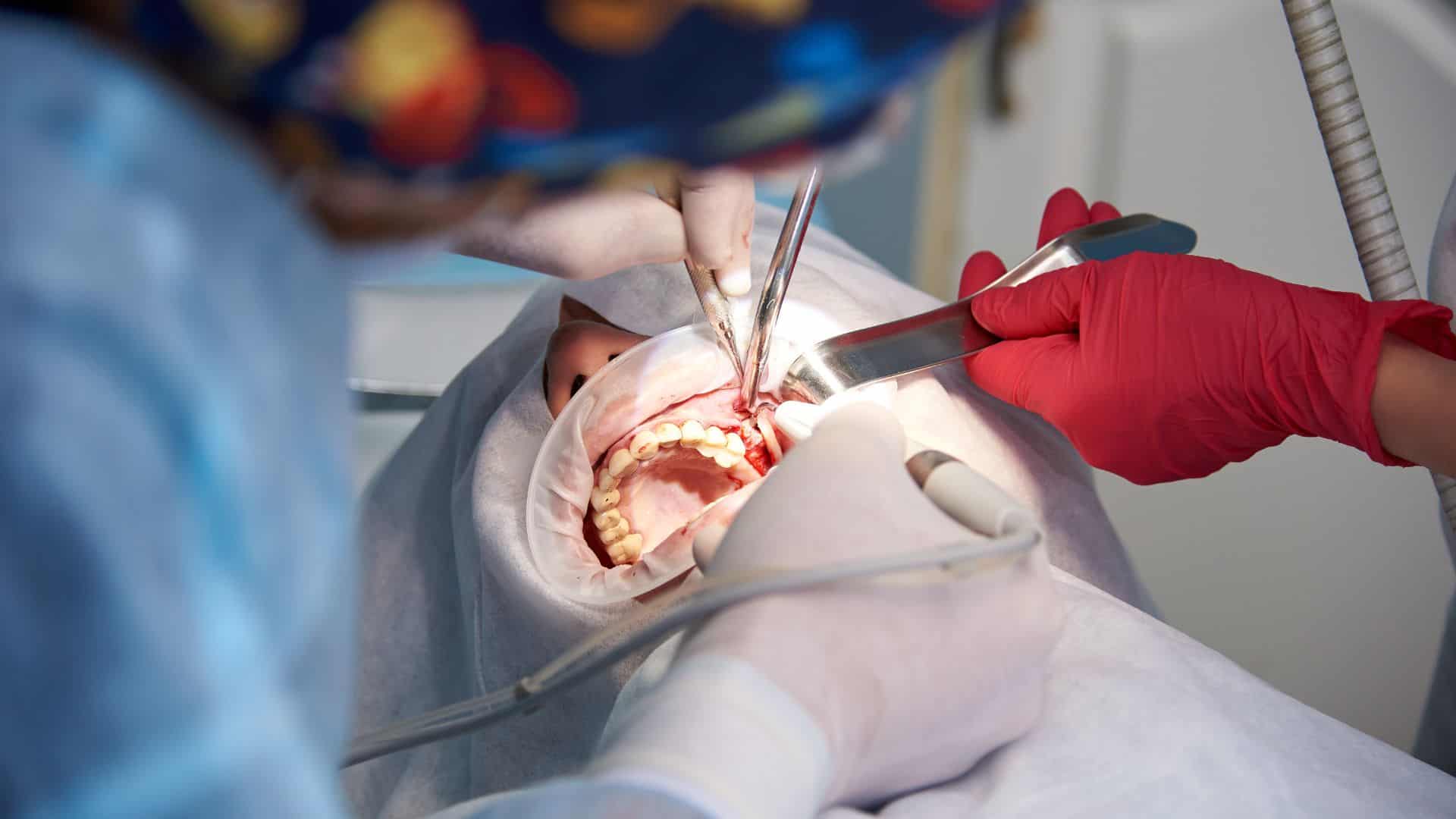 Sinus Lifting