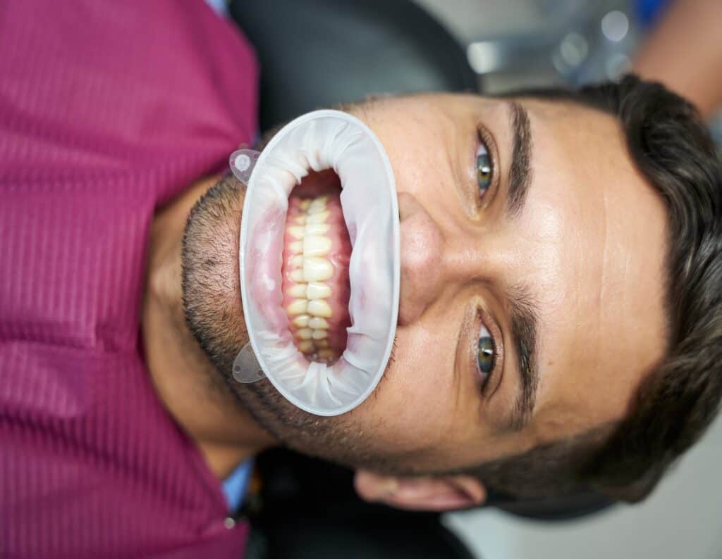 Close-up photo of handsome brunette man wearing dental dams for medical sterility.