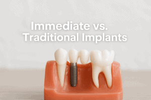 Immediate vs. traditional implants