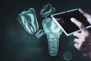 Dental implant model illustrating a replacement for a missing tooth